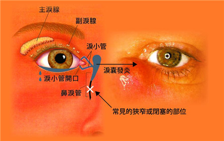 眼眶病,?，斎鹨曆劭?上海眼科醫(yī)院