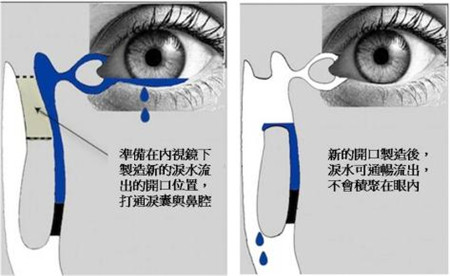 眼眶病,?，斎鹨曆劭?上海眼科醫(yī)院