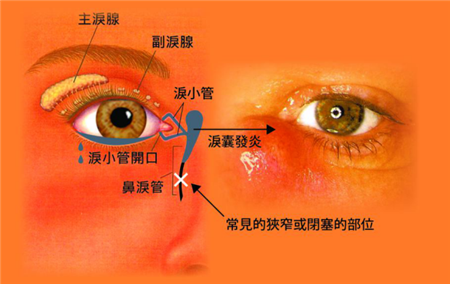 眼眶病,?，斎鹨曆劭?上海眼科醫(yī)院