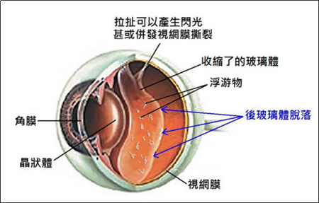 玻璃體視網(wǎng)膜,希瑪瑞視眼科,上海眼科醫(yī)院