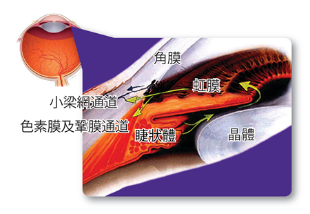 青光眼,?，斎鹨曆劭?上海眼科醫(yī)院