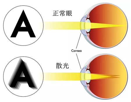 小兒眼病,?，斎鹨曆劭?上海眼科醫(yī)院