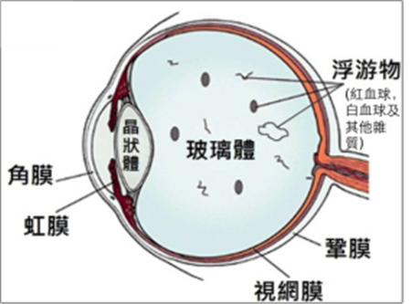 玻璃體視網(wǎng)膜,?，斎鹨曆劭?上海眼科醫(yī)院