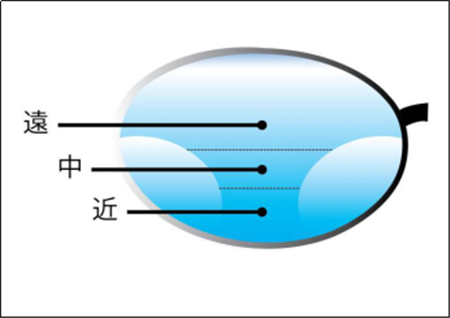 屈光矯視,?，斎鹨曆劭?上海眼科醫(yī)院