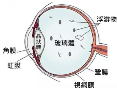 玻璃體視網(wǎng)膜,希瑪瑞視眼科,上海眼科醫(yī)院