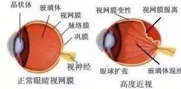 玻璃體視網(wǎng)膜,?，斎鹨曆劭?上海眼科醫(yī)院