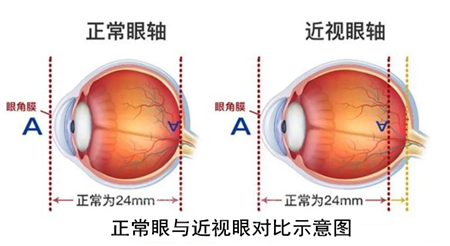 玻璃體視網(wǎng)膜,?，斎鹨曆劭?上海眼科醫(yī)院