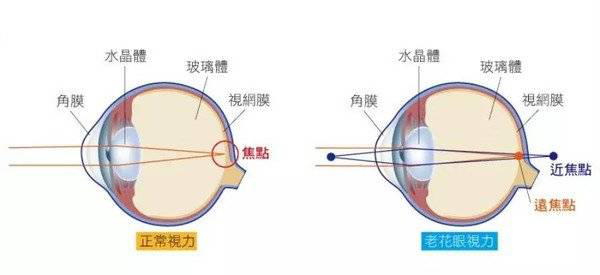 屈光矯視,希瑪瑞視眼科,上海眼科醫(yī)院
