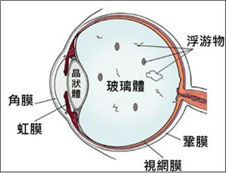 玻璃體視網(wǎng)膜,?，斎鹨曆劭?上海眼科醫(yī)院