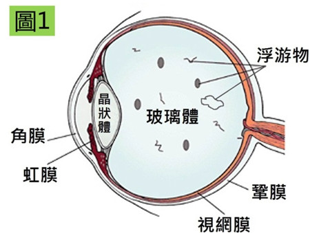 玻璃體視網(wǎng)膜,?，斎鹨曆劭?上海眼科醫(yī)院