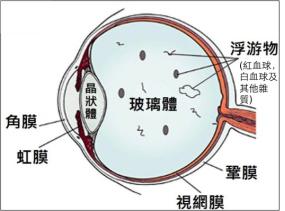 玻璃體視網(wǎng)膜,?，斎鹨曆劭?上海眼科醫(yī)院