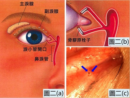 眼表眼角膜,?，斎鹨曆劭?上海眼科醫(yī)院