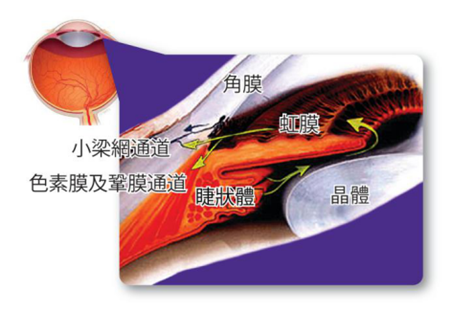青光眼,?，斎鹨曆劭?上海眼科醫(yī)院