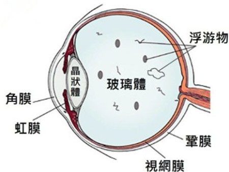 玻璃體視網(wǎng)膜,?，斎鹨曆劭?上海眼科醫(yī)院
