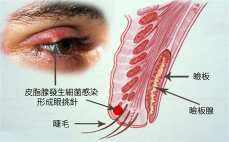 眼表眼角膜,?，斎鹨曆劭?上海眼科醫(yī)院