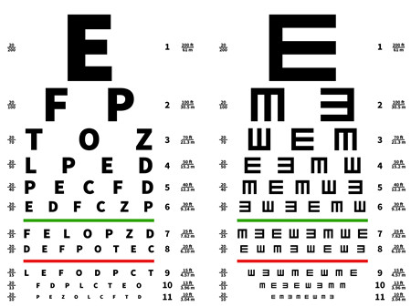 小兒眼病,希瑪瑞視眼科,上海眼科醫(yī)院
